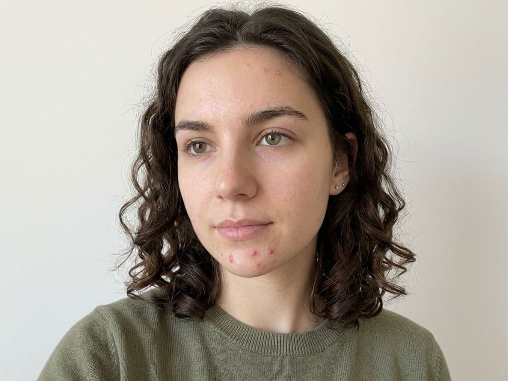 Before transformation